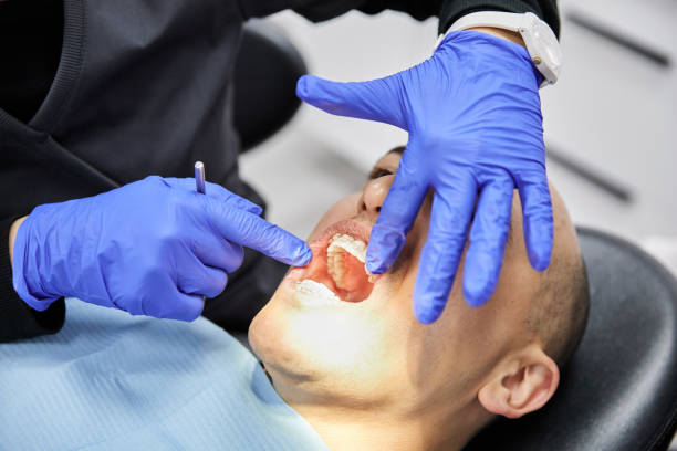 Best Emergency Dental Extractions in Lucasville, OH
